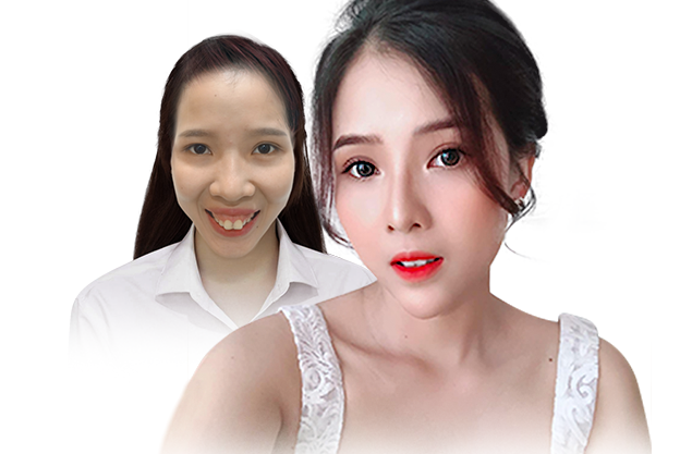 Thảo My